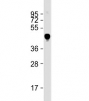 Western blot testing of MBP-tagged MART1 lysate with MBP tag antibody at 1:2000. Predicted molecular weight: 43 kDa.