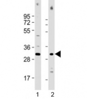 Western blot testing of human 1) Jurkat and 2) HL-60 cell lysate with COPS7B antibody at 1:1000. Predicted molecular weight: 30 kDa.