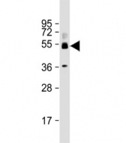 Western blot testing of human ovary lysate with SH3BP5 antibody at 1:2000. Predicted molecular weight: 50 kDa.