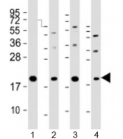 Western blot testing of human 1) HeLa, 2) PC-3, 3) T47D and 4) U-2OS cell lysate with APC11 antibody at 1:2000. Predicted molecular weight: ~10 kDa (Q9NYG5-1) or ~20 kDa (Q9NYG5-2).