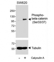 Western blot testing of extracts from SW620 cells,  untreated or treated with Calyculin A,  (100nM, 30min), with phospho-beta-Catenin antibody (pS33/37) at 1:1000.