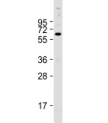 Western blot testing of human HepG2 cell lysate with PTH1R antibody at 1:2000. Predicted molecular weight: 66 kDa.