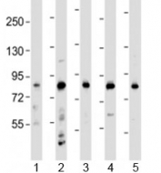 Western blot testing of human 1) HeLa, 2) HL-60, 3) THP-1, 4) CCRF-CEM and 5) SH-SY5Y cell lysate with LRCH4 antibody at 1:2000. Predicted molecular weight: 74 kDa.