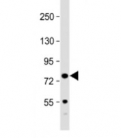 Western blot testing of mouse spleen lysate with Kindlin-3 antibody at 1:2000. Predicted molecular weight: 76 kDa.