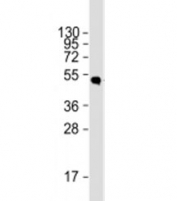 Western blot testing of 12 tag recombinant protein lysate with HSV tag antibody at 1:2000.