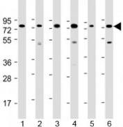 Western blot testing of human 1) Daudi, 2) HepG2, 3) Jurkat, 4) K562, 5) MOLT-4 and 5) Raji cell lysate with PABPC3 antibody at 1:2000. Predicted molecular weight: 70 kDa.