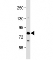 Western blot testing of human Jurkat cell lysate with SLP76 antibody at 1:2000. Predicted molecular weight of 60 kDa but routinely observed at ~76 kDa.