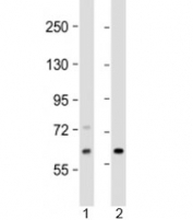 Western blot testing of human 1) Jurkat and 2) human fetal kidney lysate with EPHX2 antibody at 1:2000. Predicted molecular weight: 63/57 kDa (isoforms 1/2).