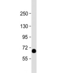 Western blot testing of human placenta lysate with STT3A antibody at 1:2000. Predicted molecular weight: 81/69 kDa (isoforms 1/2).~