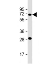 Western blot testing of human K562 cell lysate with SST3A antibody at 1:2000. Predicted molecular weigh