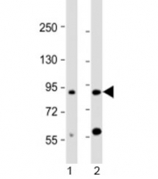 Western blot testing of human 1) brain and 2) HL-60 cell lysate with CCDC144A antibody at 1:2000. Predicted molecular weight: 165/81/134 kDa (isoforms 1/2/3).