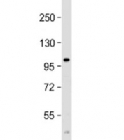 Western blot testing of human spleen lysate with PARP10 antibody at 1:2000. Predicted molecular weight ~110 kDa but can be observed at up to ~150 kDa.