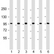 Western blot testing of human 1) HepG2, 2) U-251 MG, 3) A431, 4) HeLa, 5) CCRF-CEM and 6) HL-60 cell lysate with TAF4 antibody at 1:2000. Predicted molecular weight: 110-135 kDa.