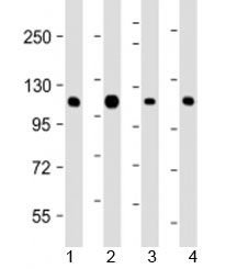 Western blot testing of human 1) K562, 2) Jurkat, 3) Raji and 4) SK-BR-3 cell lysate with CBL antibody at 1:2000. Predicted molecular weight: 100 kDa.