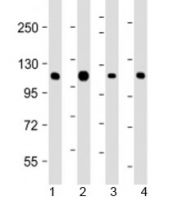 Western blot testing of human 1) K562, 2) Jurkat, 3) Raji and 4) SK-BR-3 cell lysate with CBL antibody at 1:2000. Expected molecular weight: 100-120 kDa.