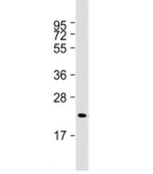 Western blot testing of human skeletal muscle lysate with Irisin antibody at 1:2000. Predicted molecular weight: 23 kDa.