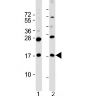 Western blot testing of human 1) MKN45 and 2) PANC-1 cell lysate with FAM159B antibody at 1:2000. Predicted molecular weight: 18 kDa.