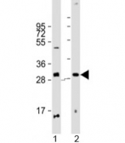 Western blot testing of human 1) pancreas and 2) placenta lysate with PPP1R3E antibody at 1:2000. Predicted molecular weight: 31 kDa.