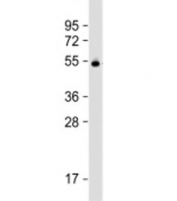 Western blot testing of human plasma lysate with Vitamin D binding protein antibody at 1:2000. Predicted molecular weight: 53 kDa.