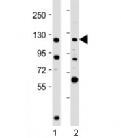Western blot testing of human 1) K562 and 2) U-2OS cell lysate with NOP2 antibody at 1:2000. Predicted molecular weight: 89 kDa but routinely observed at 100~120 kDa.