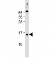 Western blot testing of human PC-3 cell lysate with SYNJBP antibody at 1:2000. Predicted molecular weight: 16 kDa.