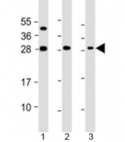 Western blot testing of 1) mouse brain, 2) mouse kidney and 3) human ThP-1 cell lysate with TPD52 antibody at 1:2000. Expected molecular weight: 24~26 kDa.