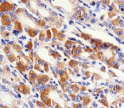 IHC testing of FFPE human stomach with PACSIN2 antibody at 1:100. HIER: steamed with pH6 citrate buffer.