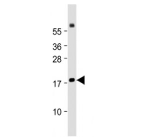 Western blot testing of Chemerin antibody at 1:2000 dilution + human lung lysate. Predicted molecular weight ~19 kDa.
