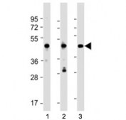 Western blot testing of NSFL1C antibody at 1:2000 + Lane 1: 293, 2: NCI-H1299 and 3: A431 whole cell lysate. Predicted molecular weight ~41 kDa.