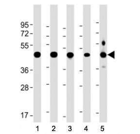 Western blot testing of NSFL1C antibody at 1:2000 + human lysate 1: 293, 2: A431, 3: NCI-H1299, 4: U-251 MG, and 5: mouse brain lysate. Predicted molecular weight ~41 kDa.