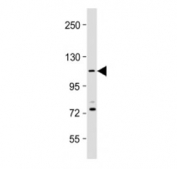 Western blot testing of PKN1 antibody at 1:2000 dilution + human Jurkat whole cell lysate. Predicted molecular weight ~104 kDa.