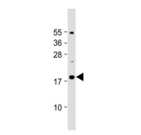 Western blot testing of IL-23 antibody at 1:2000 dilution + mouse pancreas lysate. Predicted molecular weight ~21 kDa.
