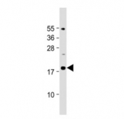 Western blot testing of IL-23 antibody at 1:2000 dilution + mouse pancreas lysate. Predicted molecular weight ~21 kDa, observed molecular weight ~19 kDa.