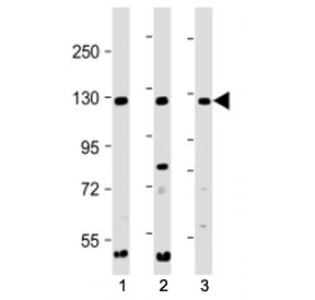 Western blot testing of INTS3 antibody at 1:2000 + Lane 1: human 293, 2: HeLa, and 3: Jurkat cell lysate. Predicted molecular weight ~118 kDa.