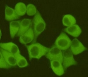 ICC/IF staining of HeLa cells fixed with 4% Paraformaldehyde, using Fatty Acid Synthase antibody at 1:400.