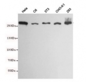 Western blot testing of Fatty Acid Synthase in human HeLa, rat C6, mouse NIH3T3, hamster CHO-K1 and human 293 cell lysates using Fatty Acid Synthase antibody at 1:1000. Predicted molecular weight ~270 kDa.