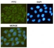 ICC/IF staining of HeLa cells (fixed with -20oC Methanol) with GSK3B antibody 1:200.