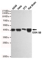 Western blot testing of human A549, human HeLa, mouse NIH3T3 and rat brain lysates using GSK3B antibody at 1:1000. Predicted molecular weight ~46 kDa.