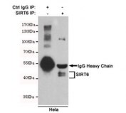 Immunoprecipitation of SIRT6 from HeLa cell lysate using SIRT6 antibody. The precipitate was subsequently immunoblotted with the same mAb.