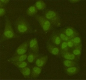 ICC/IF testing of HeLa cells, fixed by 4% paraformaldehyde, with SIRT6 antibody at 1:100.