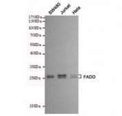 Western blot testing of SW480, Jurkat and HeLa cell lysates using FADD antibody at 1:500. Predicted molecular weight ~28 kDa.