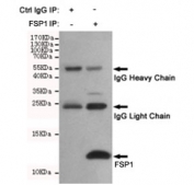 Immunoprecipitation and western blot of HeLa cell lysate using the FSP1 antibody. Predicted molecular weight ~12 kDa.