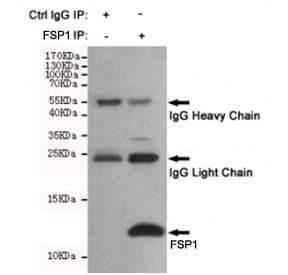 Immunoprecipitation and western blot of HeLa cell lysate using the FSP1 antibody.