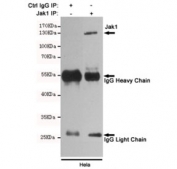 Immunoprecipitation and western blot of HeLa cell lysate using the JAK1 antibody.