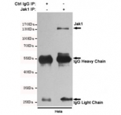 Immunoprecipitation and western blot of HeLa cell lysate using the JAK1 antibody.