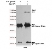 Immunoprecipitation and western blot of HeLa cell lysate using the JAK1 antibody.