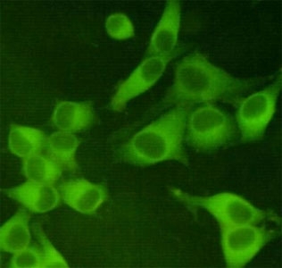 ICC/IF staining of HeLa cells, fixed with 4% Paraformaldehyde, using PKM