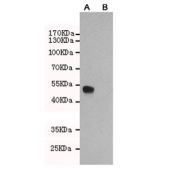 Western blot testing of A) CHO-K1 cells transfected with a partial ERa protein and B) untransfected CHO-K1 cell lysate using Estrogen Receptor alpha antibody at 1:2000. Expected size of the partial protein ~50 kDa.