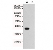 Western blot testing of A) CHO-K1 cells transfected with a partial TLR7 protein and B) untransfected CHO-K1 cell lysate using TLR7 antibody at 1:2000. Expected size of the partial protein ~40 kDa.