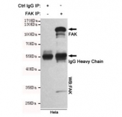 Immunoprecipitation and western blot of HeLa cell lysate using the FAK antibody.